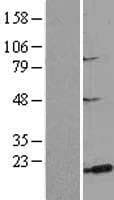 Human MSRB3 Protein (Over-Expression Lysate Myc-DDK (Flag))