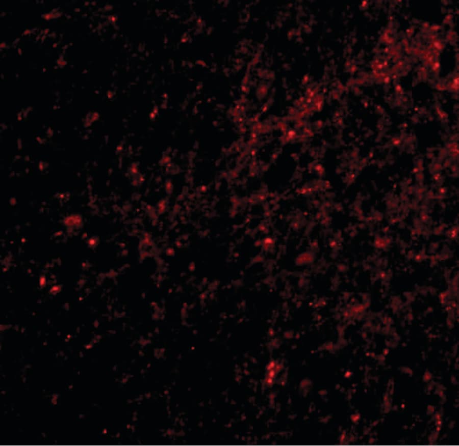 DLGAP3 / SAPAP3 Antibody
