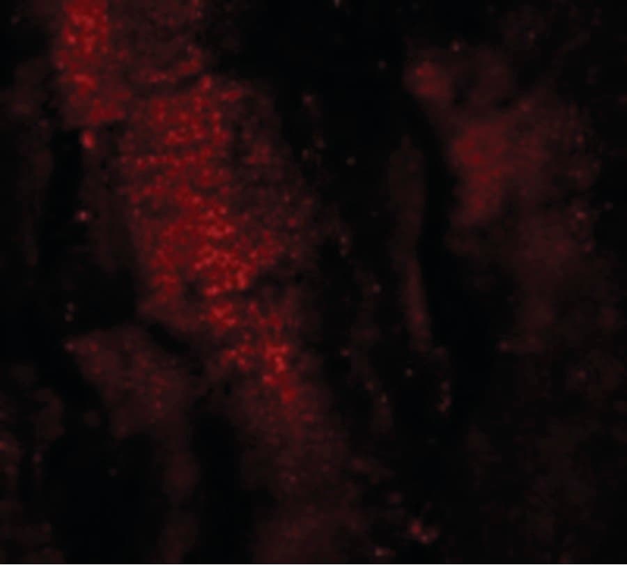 Polyclonal Rabbit anti-Human MEX3B / RKHD3 Antibody (IF, WB)