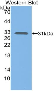 Complement C1s Antibody (aa438-685, APC)