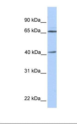 GLA / Alpha Galactosidase Antibody (aa110-159)