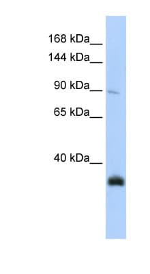 NXP2 / MORC3 Antibody (aa180-229)