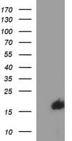 SIVA1 / SIVA Antibody (clone OTI2F8)