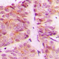 RPS6KB1 / P70S6K / S6K Antibody (C-Terminus)