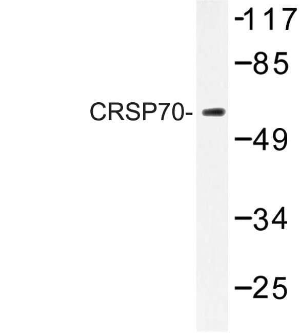 MED26 / CRSP7 Antibody (Ser7)