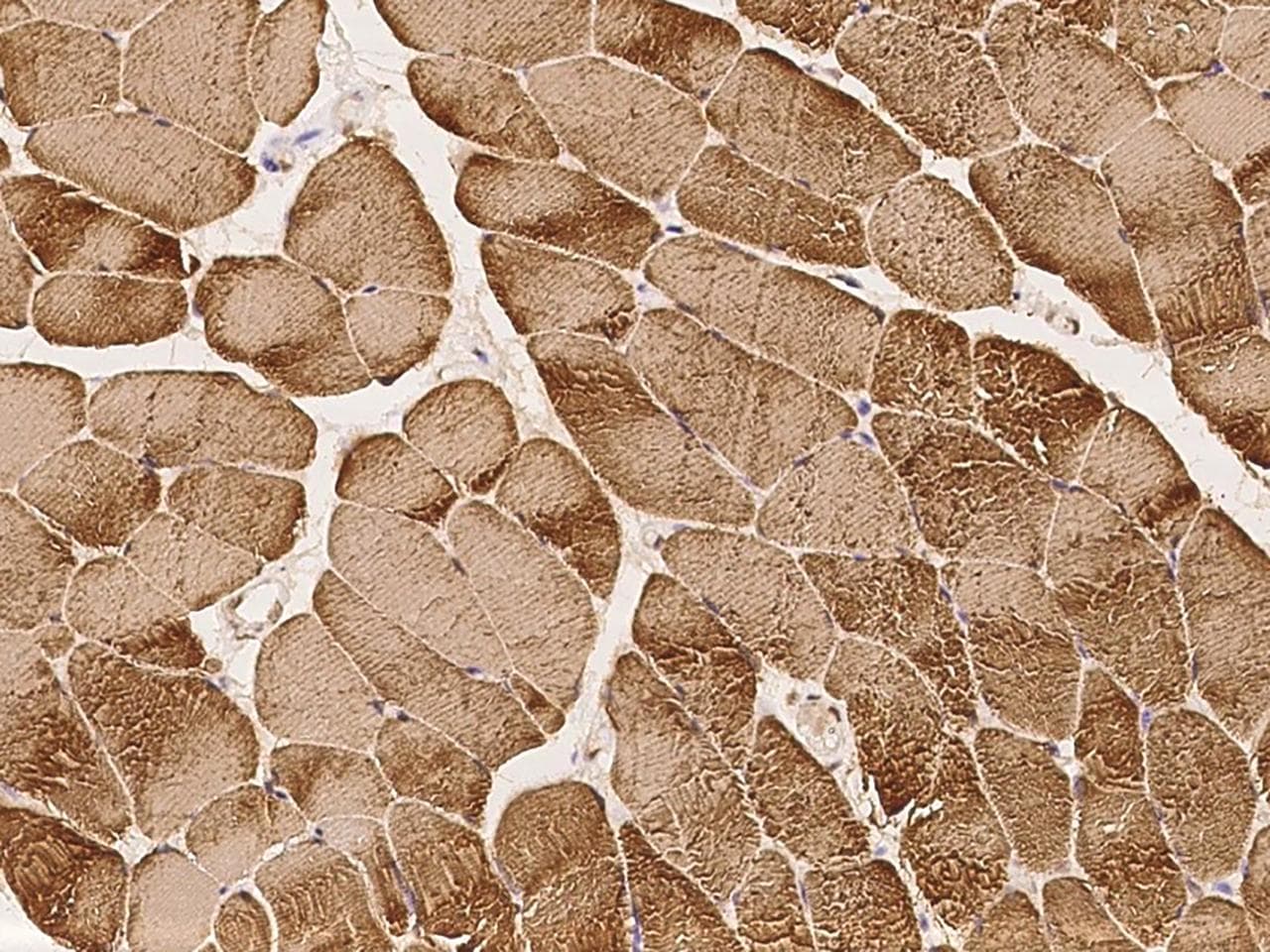 Polyclonal Rabbit anti-Human ZC3H12D Antibody (IHC)