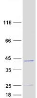 Human EBAG9 / RCAS1 Protein (Recombinant Myc-DDK (Flag))