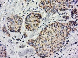 BECN1 / Beclin-1 Antibody (clone OTI3H8)