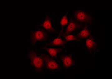 Polyclonal Rabbit anti-Human FLNA / Filamin A Antibody (phospho-Ser2152, IHC, IF, WB)