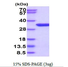 Human THYN1 / HSPC144 Protein (Recombinant His)