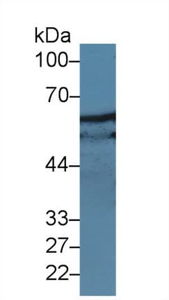 PXN / Paxillin Antibody (aa327-568, PE)