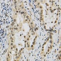 Polyclonal Rabbit anti-Human JUNB / JUN-B Antibody (Internal, IHC, WB)