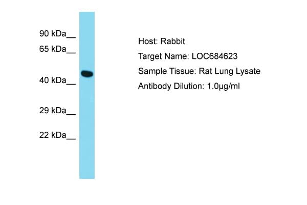 GPR52 Antibody (aa165-202)