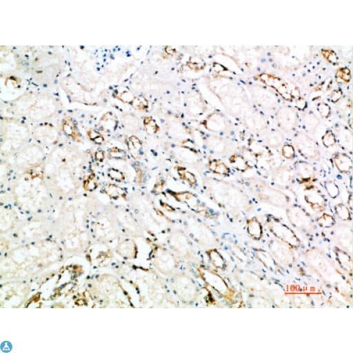 Polyclonal Rabbit anti-Human ART4 Antibody (IHC)