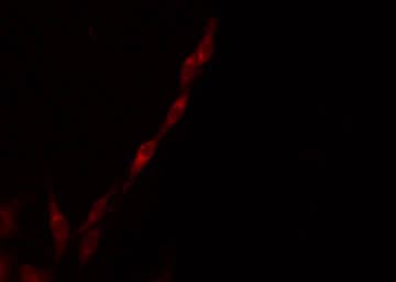 Polyclonal Rabbit anti-Human ME3 Antibody (IF, WB)