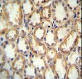 Polyclonal Rabbit anti-Human KCNT2 / KCa4.2 Antibody (aa1069-1097, IHC, WB)