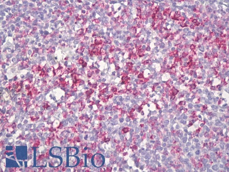 IHC-plus™ SLC2A3 / GLUT3 Antibody (aa447-496)