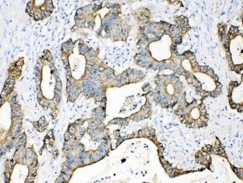 Polyclonal Rabbit anti-Human KRT18 / CK18 / Cytokeratin 18 Antibody (IHC, WB)