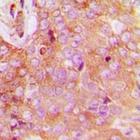 FAM84B Antibody (N-Terminus)