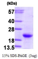 Human NRAS / N-ras Protein (Recombinant)
