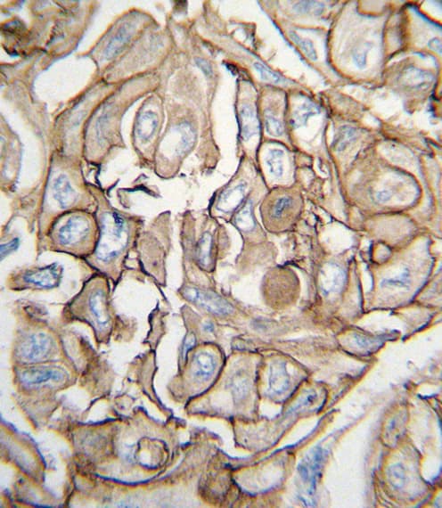 HRAS / H-Ras Antibody (aa104-128)