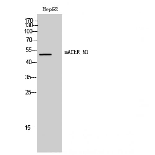 IHC-plus™ CHRM1 / M1 Antibody (270-350 aa, Internal)