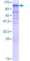 Human TBCK / TBCKL Protein (Recombinant GST)