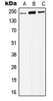 Polyclonal Rabbit anti-Human MORF / MYST4 Antibody (Internal, WB)