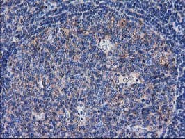 SULT1C2 / Sulfotransferase 1C2 Antibody (clone OTI4G1)
