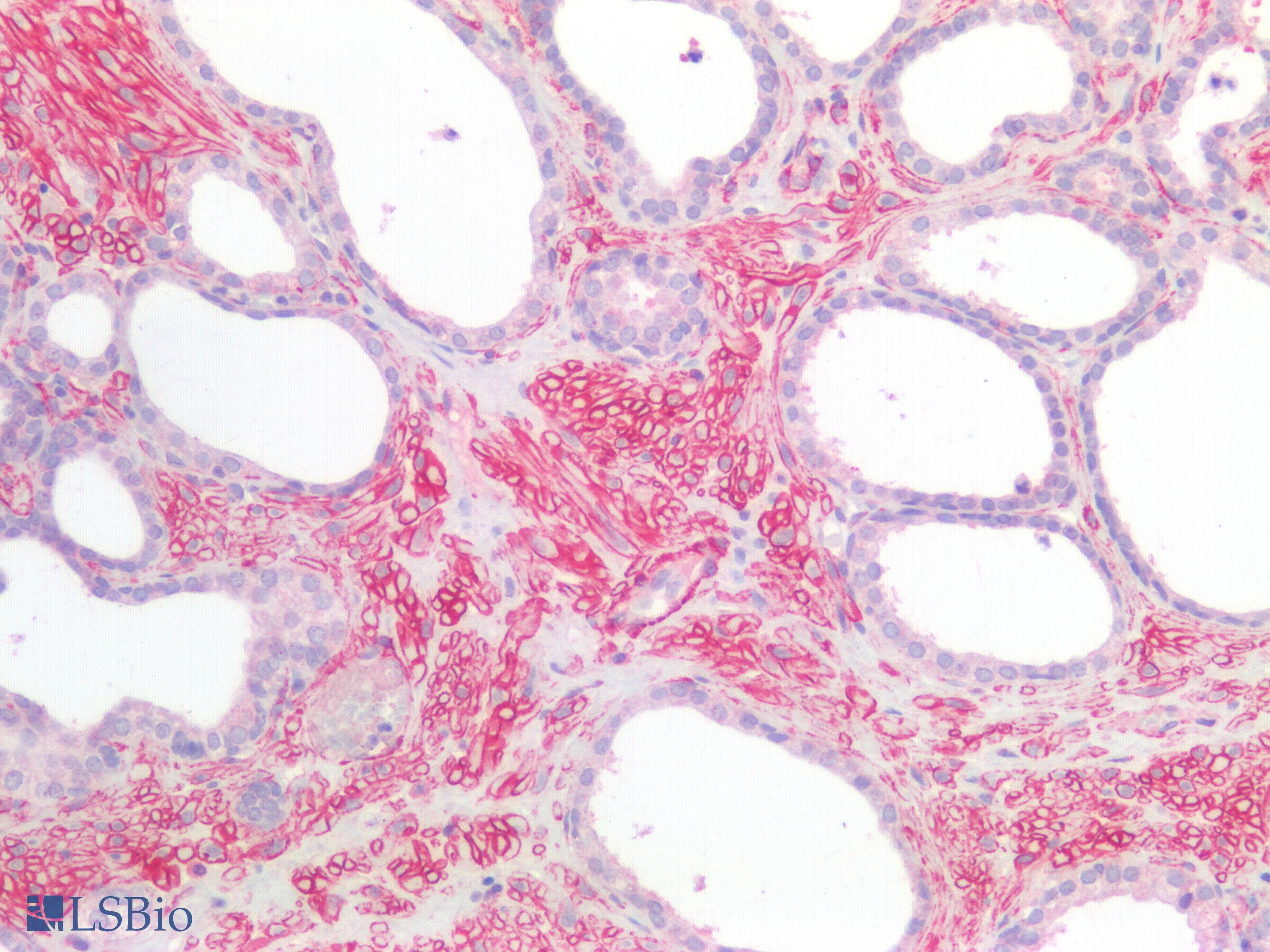 PathPlus™ HTR1B / 5-HT1B Receptor Antibody