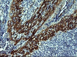 CDH3 / P-Cadherin Antibody (clone 2D5, Carrier-free)