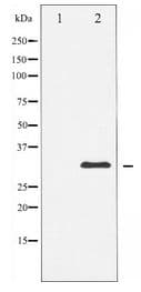 CCND1 / Cyclin D1 Antibody