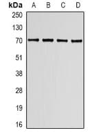 LBR / Lamin B Receptor Antibody