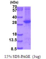 Human MAP2K6 / MEK6 / MKK6 Protein (Recombinant His)