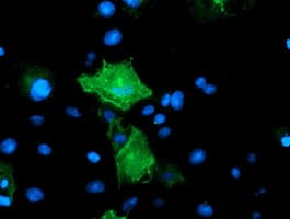 PECAM-1 / CD31 Antibody (clone 1H6, Carrier-free)