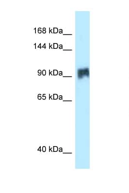SIK2 / SNF1LK2 Antibody (aa281-330)