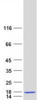 Human MUSTN1 Protein (Recombinant Myc-DDK (Flag))