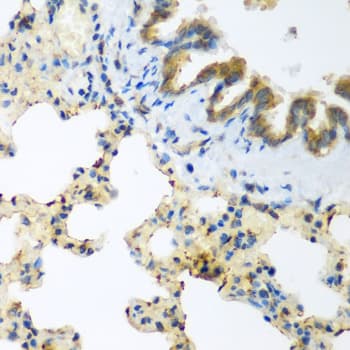 LLGL2 Antibody