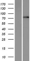 TBC1D25 Protein (Over-Expression Lysate Myc-DDK (Flag))