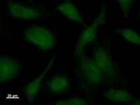 PPP1R13L / iASPP Antibody (clone 2808C5a)