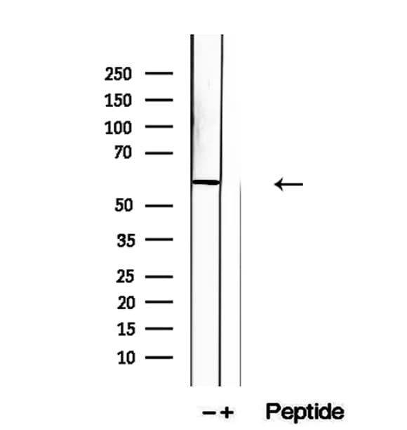 Polyclonal Rabbit anti-Human KIF12 Antibody (IHC, WB)