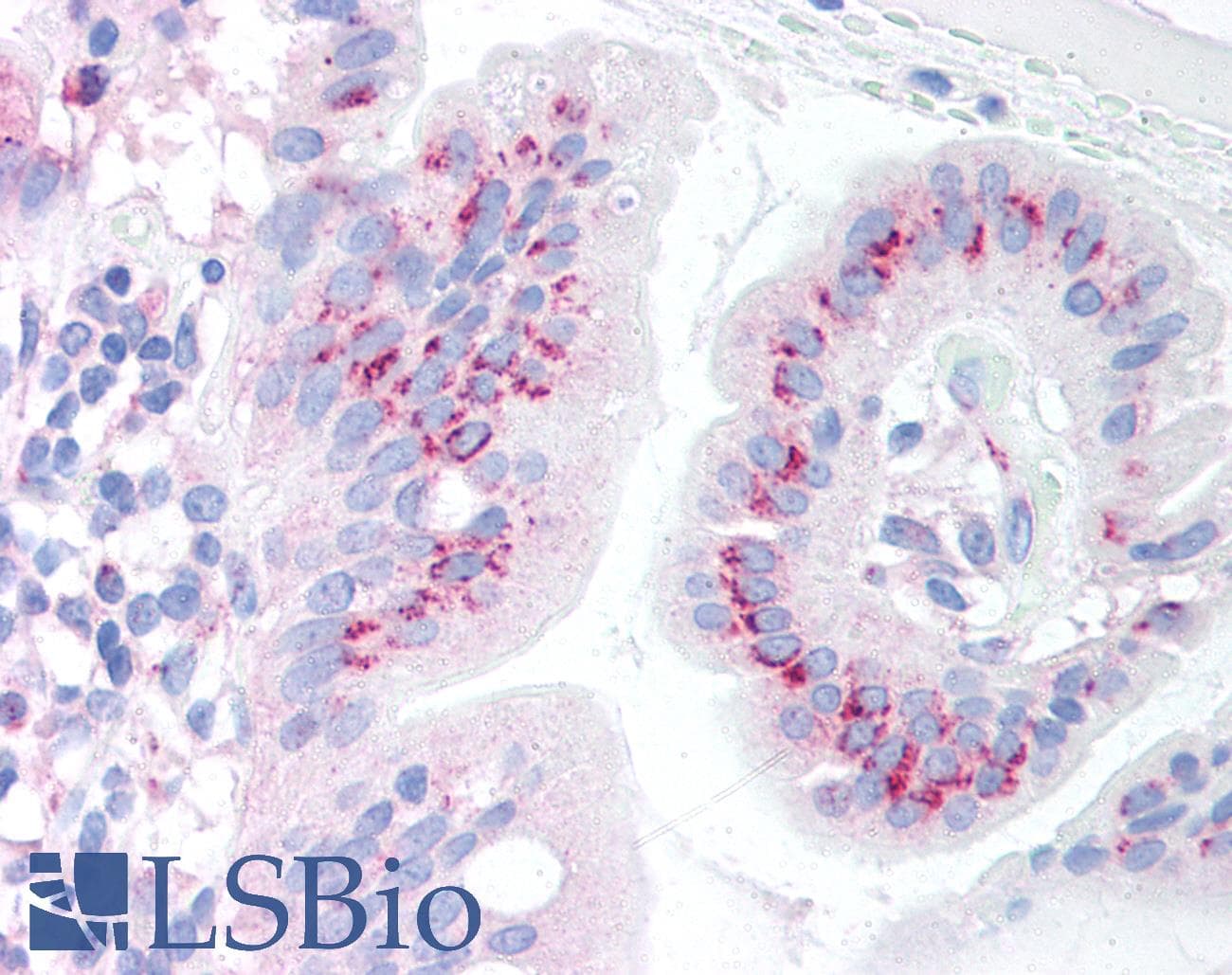 IHC-plus™ Polyclonal Rabbit anti-Human BBC3 / PUMA Antibody (IHC, IF, WB)