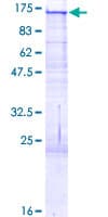 Human BCAN / Brevican Protein (Recombinant GST, N-terminus)