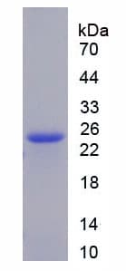 Mouse AGR2 Protein (Recombinant His-S)