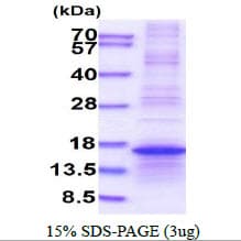 Human L35A / RPL35A Protein (Recombinant His)