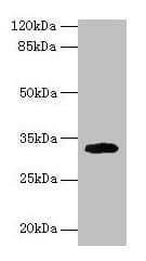 CD74 / CLIP Antibody