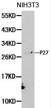 CDKN1B / p27 Kip1 Antibody