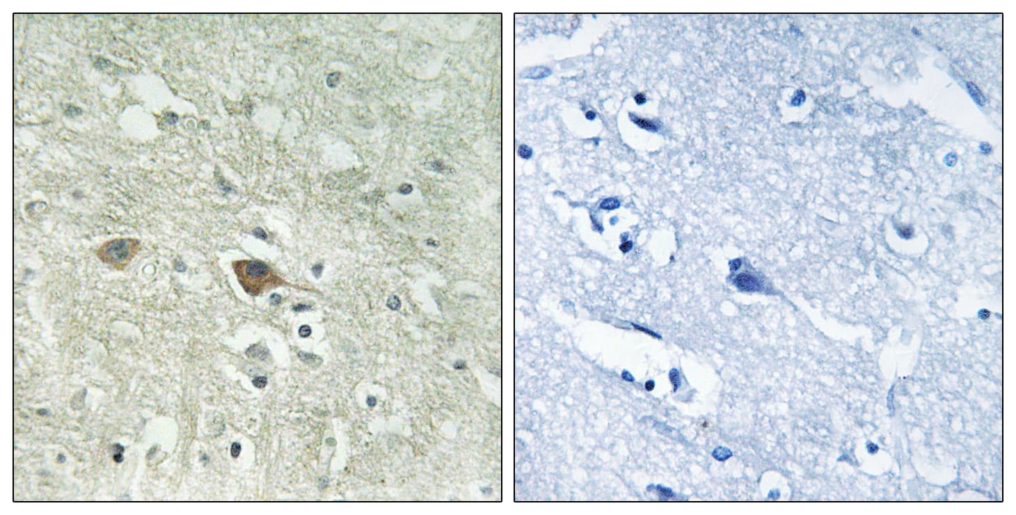 Polyclonal Rabbit anti-Human NDUFV3 Antibody (aa26-75, IHC)