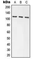 AXIN1 / Axin-1 Antibody (Internal)