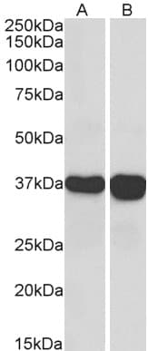 IHC-plus™ Polyclonal Goat anti-Human GAPDH Antibody (aa279-290, IHC, IF, WB)